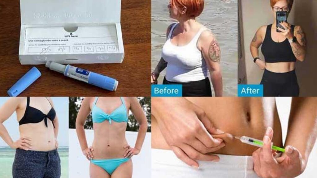 ozempic-weight-loss-before-and-after-pictures-best-health-insider